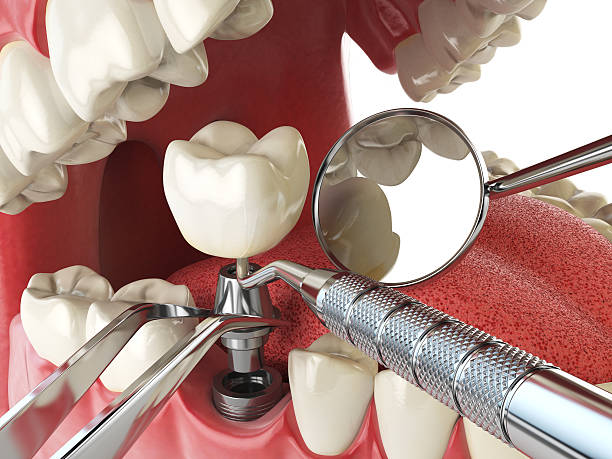 Best Emergency Broken Tooth Repair in Siesta Acres, TX
